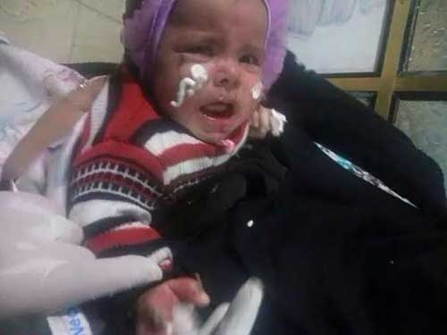 &rsquo;حزم السعودية&rsquo; ضد اطفال اليمن