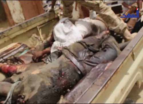 مشاهد وصور مروعة للمجازر السعودية في اليمن - يرجى عدم المشاهدة  لاصحاب القلوب الضعيفة