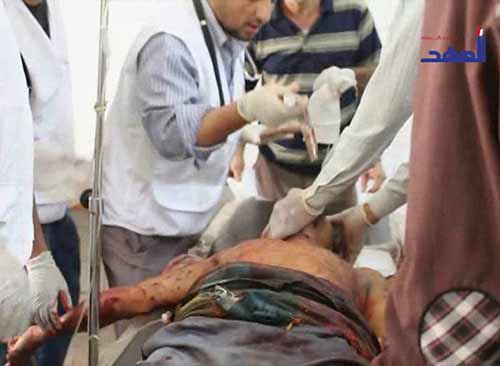 مشاهد وصور مروعة للمجازر السعودية في اليمن - يرجى عدم المشاهدة  لاصحاب القلوب الضعيفة