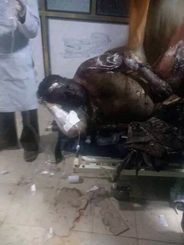 مشاهد وصور مروعة للمجازر السعودية في اليمن - يرجى عدم المشاهدة  لاصحاب القلوب الضعيفة