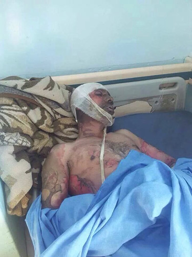 مشاهد وصور مروعة للمجازر السعودية في اليمن - يرجى عدم المشاهدة  لاصحاب القلوب الضعيفة