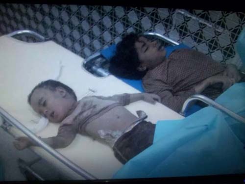 عدوان سعودي - خليجي بإشراف أميركي على الشعب اليمني