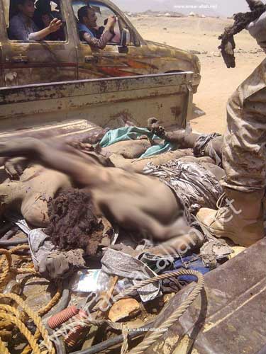 بالفيديو: مجزرة مروعة ترتكبها الطائرات الحربية السعودية في غارات على مخيم المزرق في &rsquo;حجّة&rsquo; اليمنية