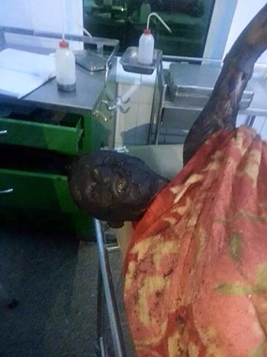 مشاهد وصور مروعة للمجازر السعودية في اليمن - يرجى عدم المشاهدة  لاصحاب القلوب الضعيفة