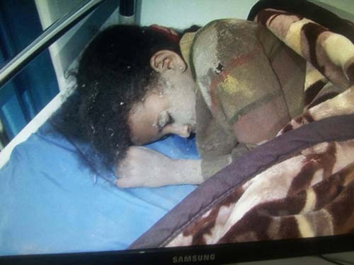 عدوان سعودي - خليجي بإشراف أميركي على الشعب اليمني