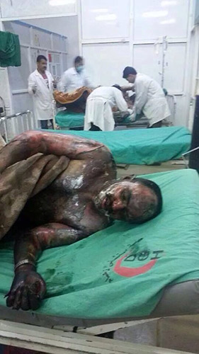 مشاهد وصور مروعة للمجازر السعودية في اليمن - يرجى عدم المشاهدة  لاصحاب القلوب الضعيفة