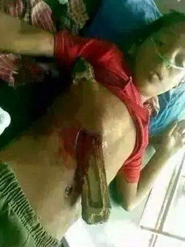 مجازر جديدة بحق اليمنيين غالبية ضحاياها من الأطفال والنساء