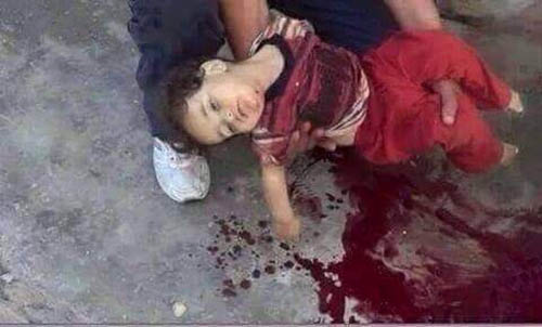 مجازر جديدة بحق اليمنيين غالبية ضحاياها من الأطفال والنساء