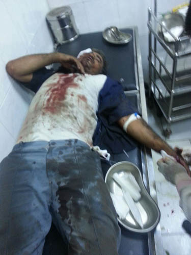 مجازر جديدة بحق اليمنيين غالبية ضحاياها من الأطفال والنساء