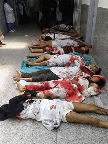 مجازر جديدة بحق اليمنيين غالبية ضحاياها من الأطفال والنساء