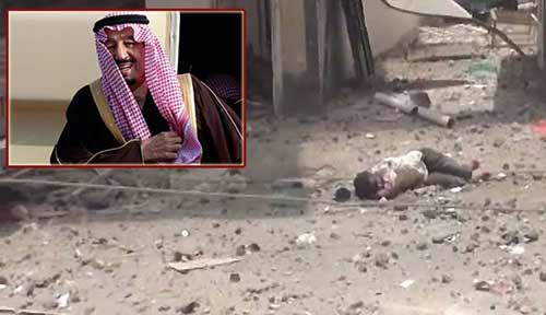 العدوان السعودي على اليمن القلم ... طال عمرك!