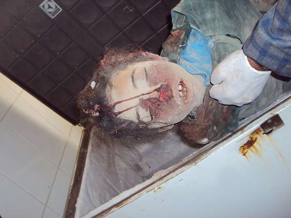 حين استيقظت &rsquo;نخوة العرب&rsquo;.. على أجساد أطفال اليمن