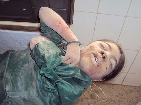 حين استيقظت &rsquo;نخوة العرب&rsquo;.. على أجساد أطفال اليمن