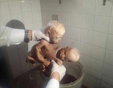 بالصورة: أجنّة محنّطة في صيدا! 