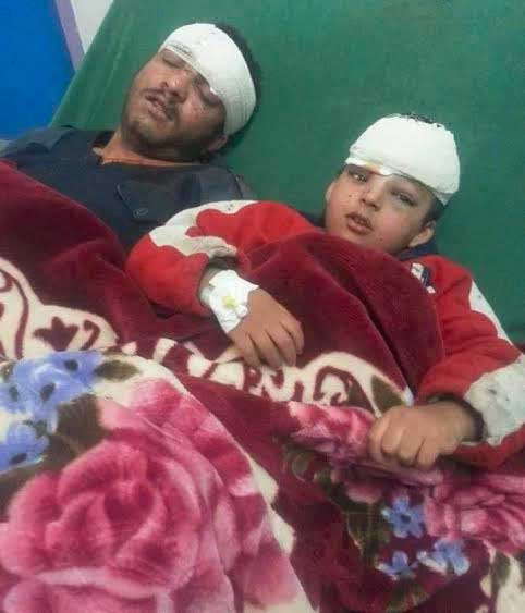 العدوان السعودي المفلس يستهدف ضريح الإمام الهادي بصعدة.. وقبائل تتحضر للثأر منه