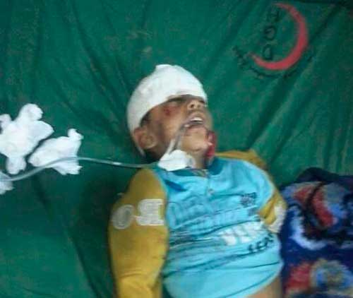 العدوان السعودي المفلس يستهدف ضريح الإمام الهادي بصعدة.. وقبائل تتحضر للثأر منه