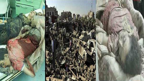 العدوان السعودي على اليمن ’ردُّ الجميل’ يهزم ’عاصفة الحزم’ وإعادة الأمل’