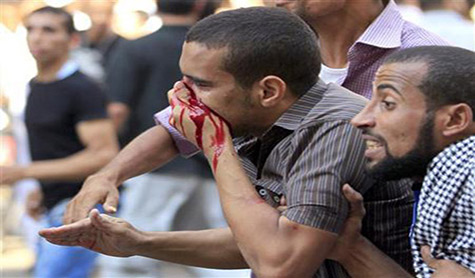 اشتباكات خلال الاستفتاء بمصر والمعارضة: هناك "تزوير"