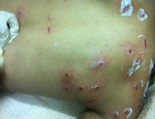 المعارضة البحرينية تستغرب التصعيد في ظل الحوار