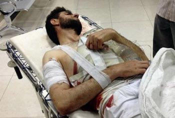 جريح سوري يدخل إلى &rsquo;إسرائيل&rsquo; لتلقي العلاج