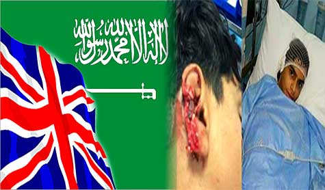 إصابة فتى برصاص الأمن السعودي في العوامية