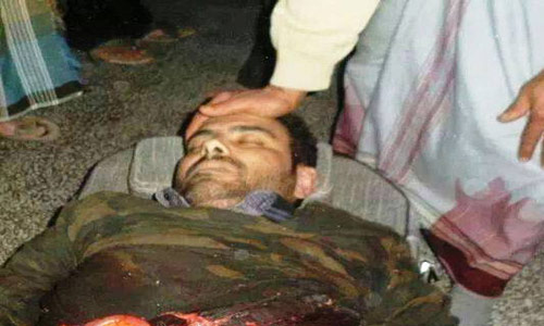 الجيش اليمني يقصف مدينة الضالع بالمدفعية الثقيلة