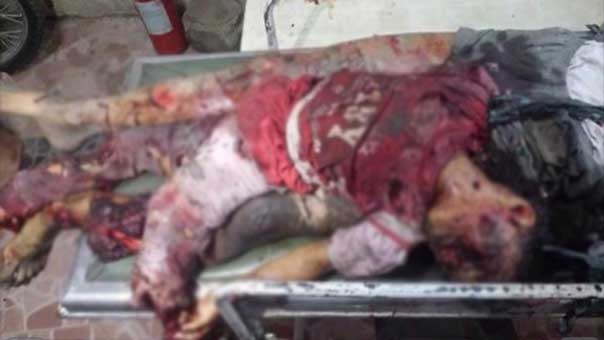 مجزرة جديدة في اليمن فاقت حصيلتها الـ60 شهيداً.. وإسقاط أباتشي سعودية فوق جيزان