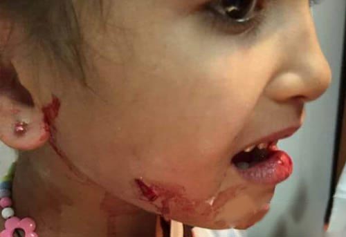 بالصور: كلاب مسعورة تهاجم الاطفال في صور