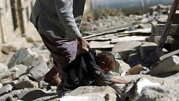 27029 بين شهيد وجريح حصيلة ضحايا عام من العدوان السعودي على اليمن

