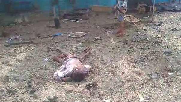 همجية ال سعود تطال المستشفيات وتقتل الاطفال في اليمن