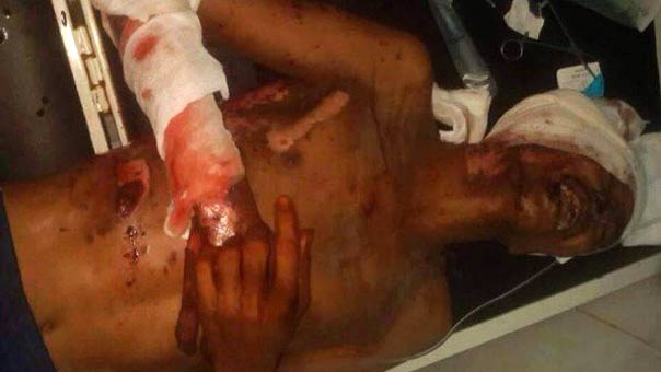 أكثر من 90 شهيدًا يمنيًا وعشرات الجرحى بغارات العدوان أمس.. ومجزرة لتحالف الرياض بقصف مديرية أمن الزيدية في الحديدة