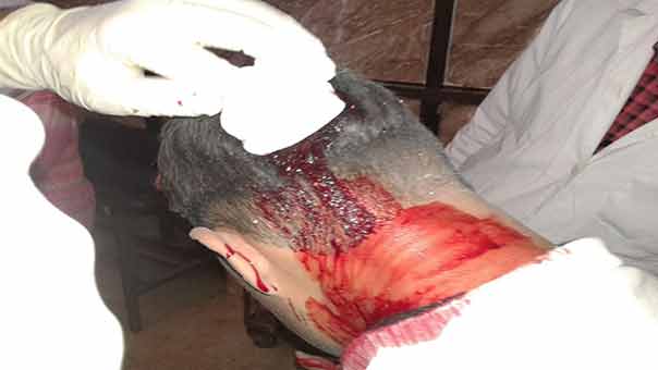 قصف غادر على الفوعة المحاصرة يوقع عددا من الاصابات بين الأهالي