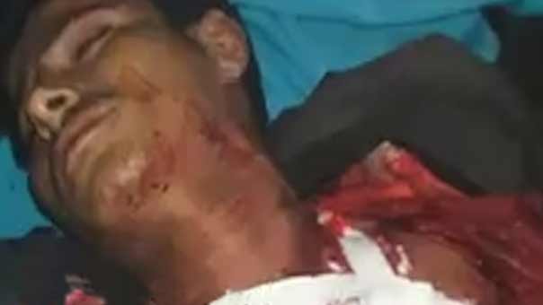 العدوان السعودي يرتكب مجزرة مروعة جديدة في تعز قبيل ساعات من وقف اطلاق النار