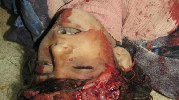 بالصور: فظاعة جرائم المسلحين بحق الاطفال في الفوعة وكفريا