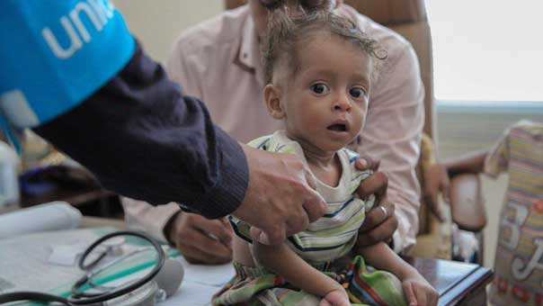 الكوليرا تفتك باليمنيين والسعودية على القائمة السوداء

