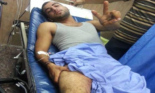 عشرات الإصابات خلال مواجهات عنيفة في نابلس والقدس والاحتلال يعتقل 7 فلسطينيين