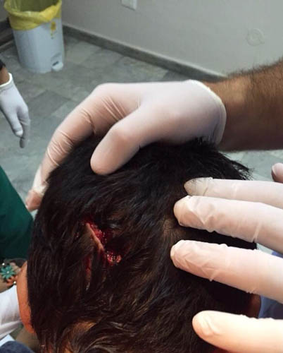 بالصور: كلاب مسعورة تهاجم الاطفال في صور