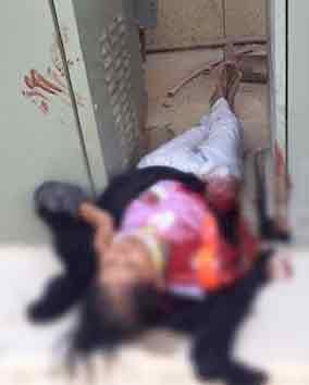 سعودية تقطع ذراع خادمتها الهندية في الرياض ونيودلهي تقدّم شكوى