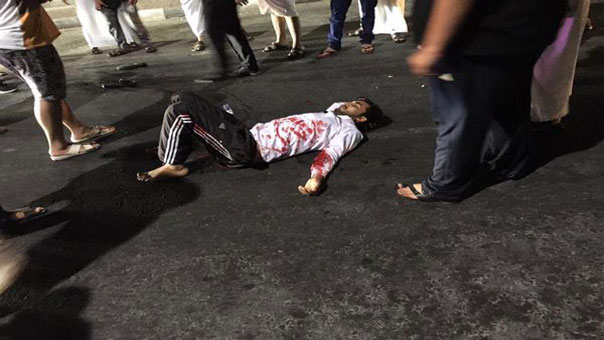 بالصور: شهداء وجرحى في هجوم إرهابي على مسجد وحسينية في المنطقة الشرقية في السعودية
