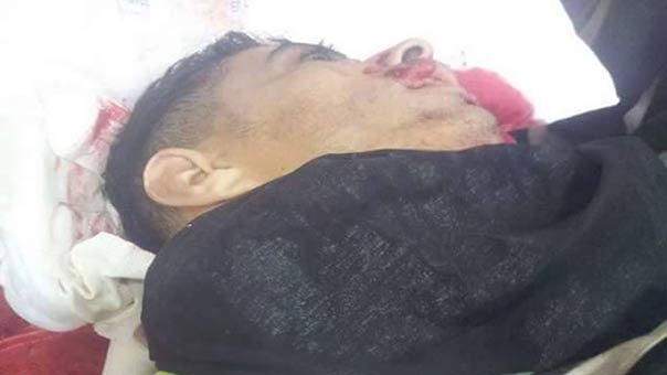 مقتل مستوطن وجرح 50 في انقلاب شاحنة شمال غربي رام الله