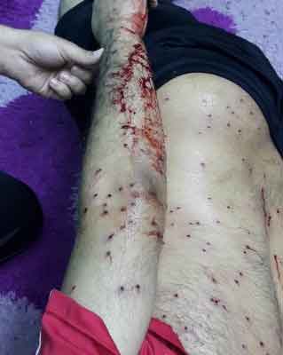 الشوزن يلاحق المتظاهرين السلميين في البحرين مجدّدًا!