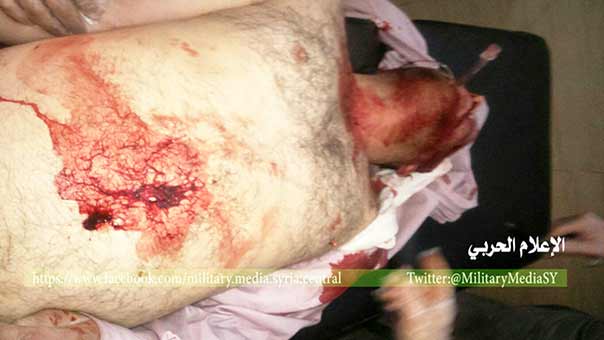 اين حصار &rsquo;مضايا&rsquo; من حصار &rsquo;نبل&rsquo; و &rsquo;الزهراء&rsquo;