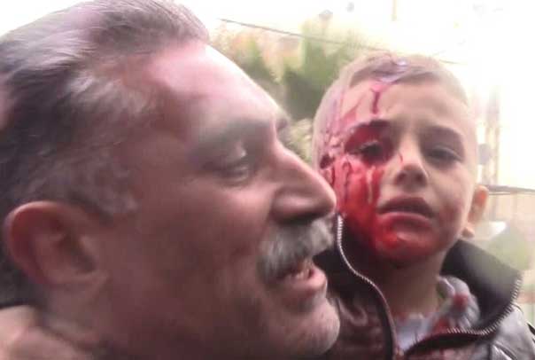 عشرات الشهداء والجرحى في تفجيرات إرهابية ضربت منطقة السيدة زينب (ع) بريف دمشق