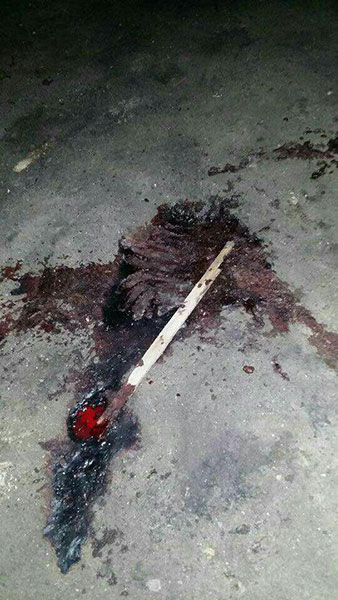 ارتفاع حصيلة اعتداءات الأمن السعودي في العوامية بالقطيف الى شهيدين وعشرات الجرحى