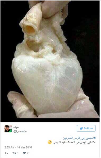 مغردون سعوديون للسيسي: &rsquo;يا بتاع الرز إيدك في جيوب السعوديين&rsquo;