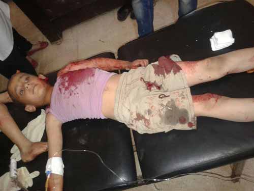 بالصور.. أطفالٌ شهداء في كفريا والفوعة أمام مرأى الأمم المتحدة