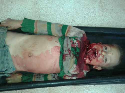 بالصور.. أطفالٌ شهداء في كفريا والفوعة أمام مرأى الأمم المتحدة