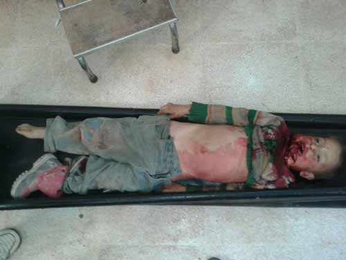 بالصور.. أطفالٌ شهداء في كفريا والفوعة أمام مرأى الأمم المتحدة