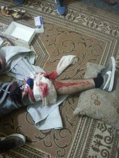 إصابات واعتقالات خلال مواجهات عنيفة في القدس المحتلة .. والعدو يعترف بإصابة اثنين من جنوده