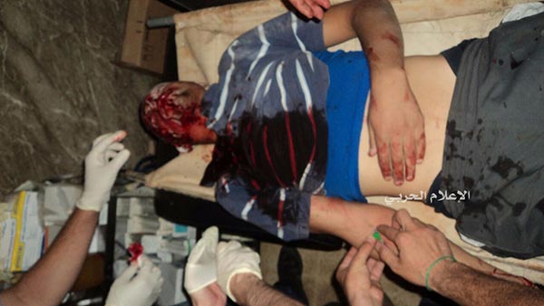 بالصور - الإرهابيون يواصلون استهداف المدنيين في الفوعة وكفريا المحاصرتين بريف إدلب